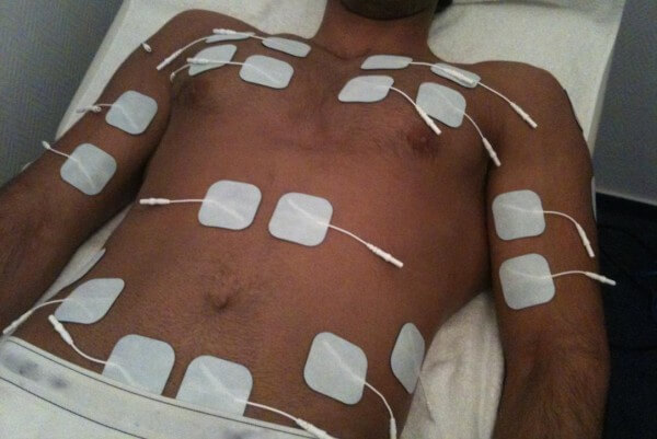 Elektrische Muskelstimulation EMS