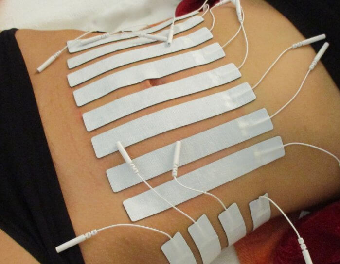 Fettreduktion Bauch